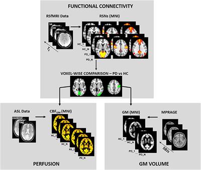 Multimodal Evaluation of Neurovascular Functionality in Early Parkinson's Disease